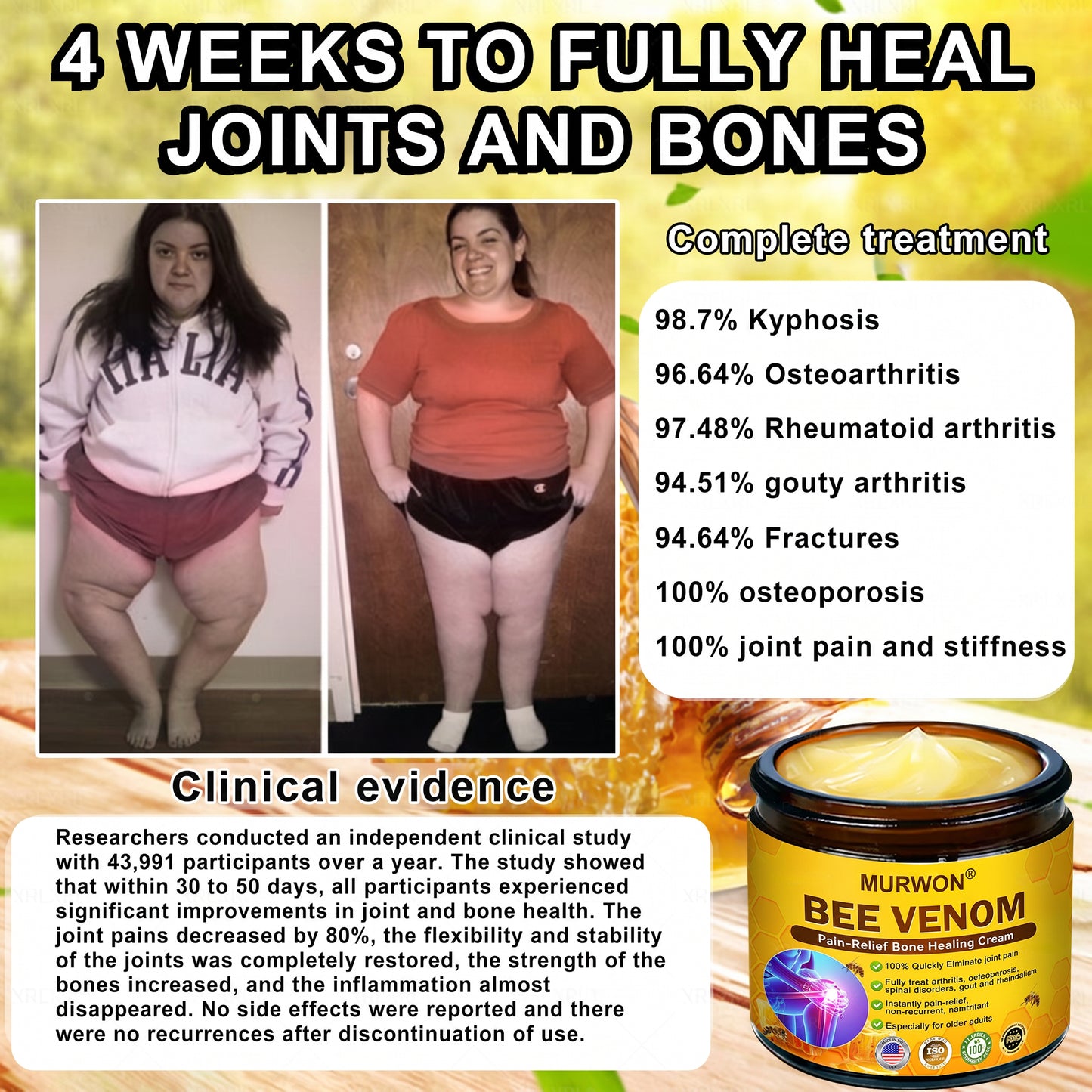 30% Discount🎁🎁|𝐌𝐔𝐑𝐖𝐎𝐍® Bee Venom Pain-Relief Bone Healing Cream ✨✨✨(Specially for older adults)